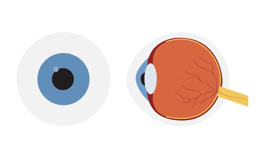 Prehospital Pupil Checking