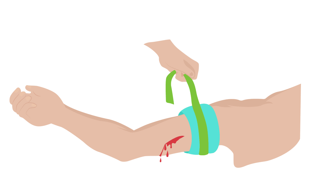 Prehospital Catastrophic Haemorrhage
