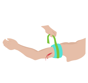 Catastrophic Haemorrhage