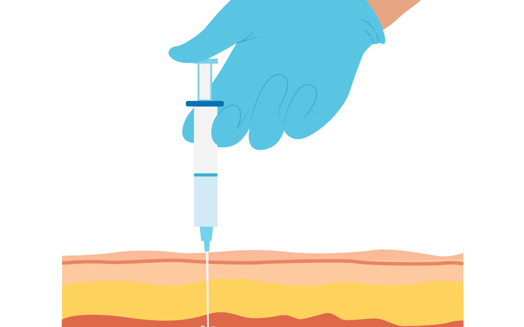 Intramuscular (IM) Injection