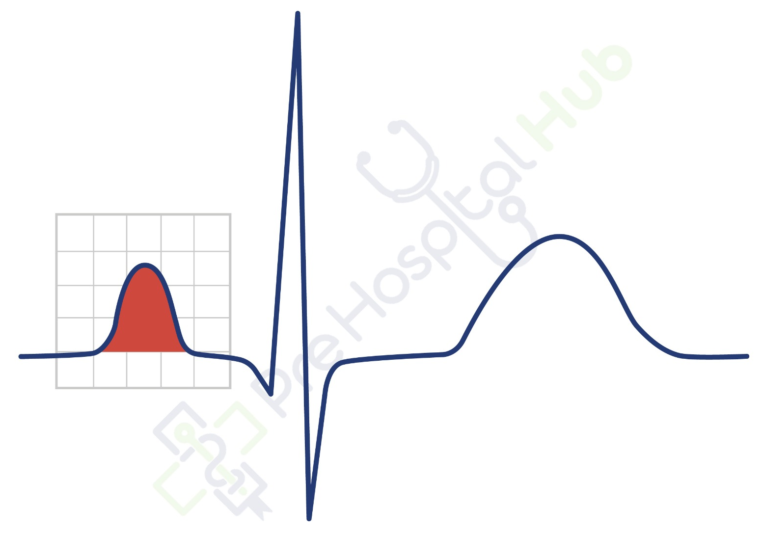 Normal P Wave