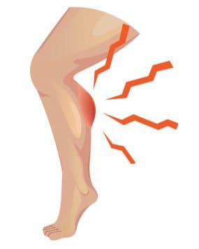 Rhabdo Muscle Cramps small