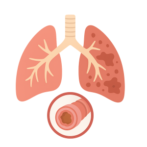 COPD Image